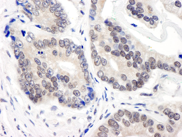 Immunohistochemistry (Formalin/PFA-fixed paraffin-embedded sections) - Anti-COPS3/CSN3 antibody (AB12321)