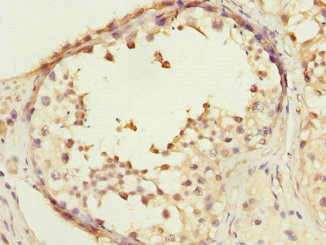 Immunohistochemistry (Formalin/PFA-fixed paraffin-embedded sections) - Anti-COPS3/CSN3 antibody (AB229807), expandable thumbnail