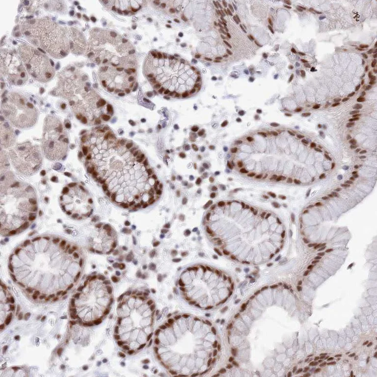 Immunohistochemistry (Formalin/PFA-fixed paraffin-embedded sections) - Anti-COPS6 antibody (AB251902)