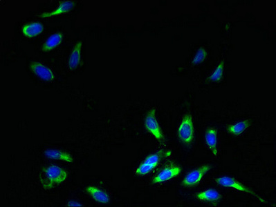 Immunocytochemistry/ Immunofluorescence - Anti-COPT2 antibody (AB238911), expandable thumbnail