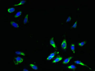 Immunocytochemistry/ Immunofluorescence - Anti-COPT2 antibody (AB238911)