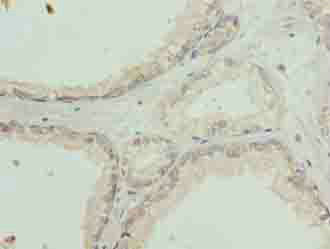 Immunohistochemistry (Formalin/PFA-fixed paraffin-embedded sections) - Anti-COPT2 antibody (AB238911), expandable thumbnail
