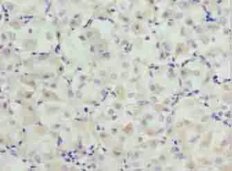 Immunohistochemistry (Formalin/PFA-fixed paraffin-embedded sections) - Anti-COPT2 antibody (AB238911)