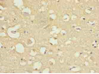 Immunohistochemistry (Formalin/PFA-fixed paraffin-embedded sections) - Anti-COPZ1 antibody (AB236670)