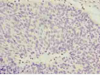 Immunohistochemistry (Formalin/PFA-fixed paraffin-embedded sections) - Anti-COPZ1 antibody (AB236670)