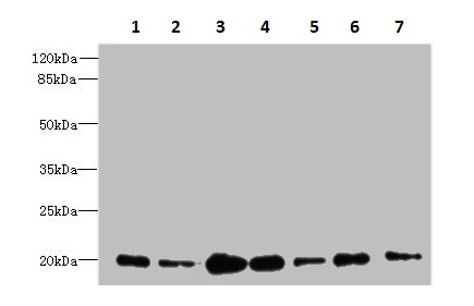 Western blot - Anti-COPZ1 antibody (AB236670)