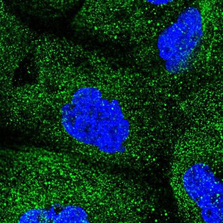 Immunocytochemistry/ Immunofluorescence - Anti-COQ2 antibody (AB220914)