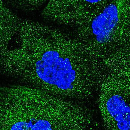 Immunocytochemistry/ Immunofluorescence - Anti-COQ2 antibody (AB220914)