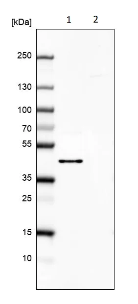 Western blot - Anti-COQ2 antibody (AB220914)