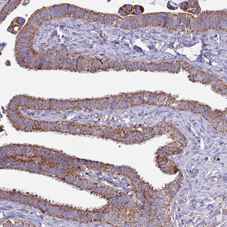 Immunohistochemistry (Formalin/PFA-fixed paraffin-embedded sections) - Anti-COQ4 antibody (AB126295)