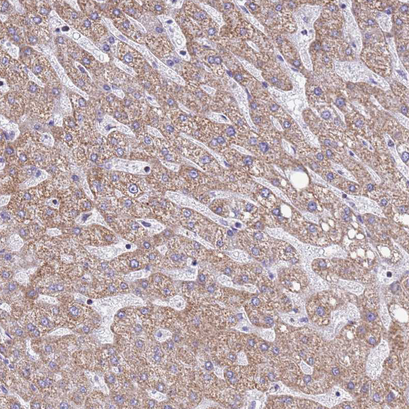 Immunohistochemistry (Formalin/PFA-fixed paraffin-embedded sections) - Anti-COQ4 antibody (AB126295)