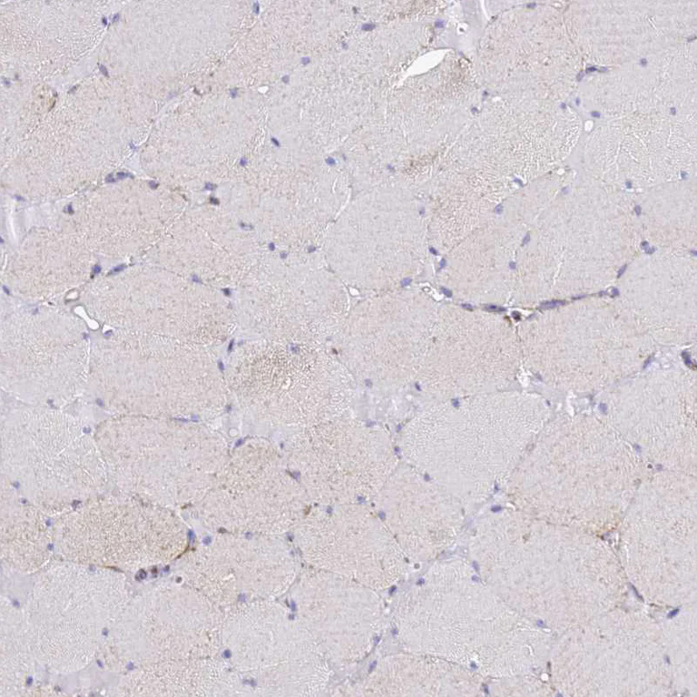 Immunohistochemistry (Formalin/PFA-fixed paraffin-embedded sections) - Anti-COQ4 antibody (AB126295)