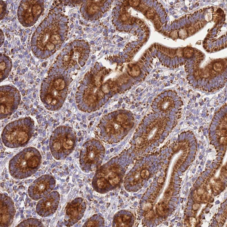 Immunohistochemistry (Formalin/PFA-fixed paraffin-embedded sections) - Anti-COQ4 antibody (AB126295)