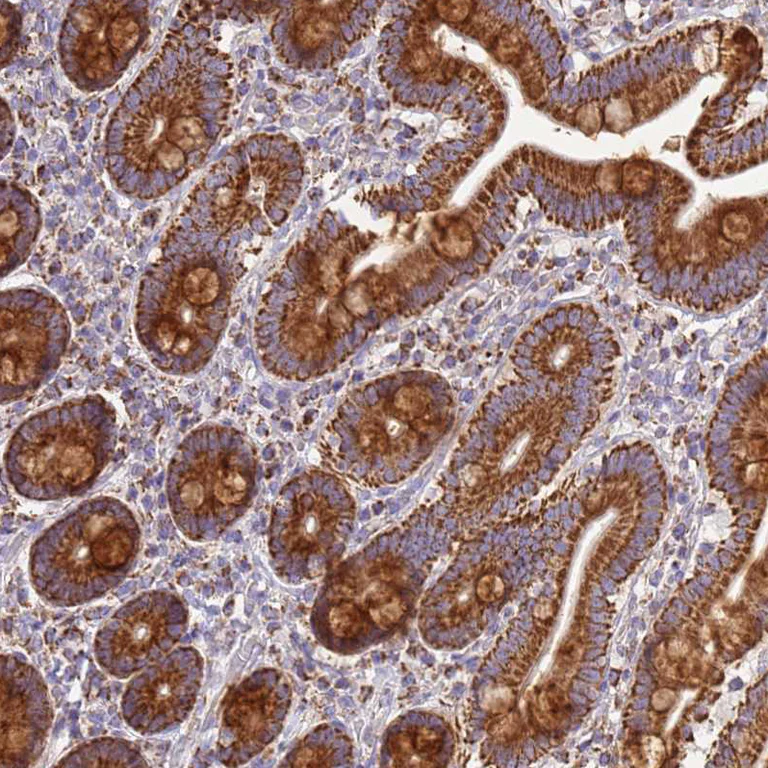 Immunohistochemistry (Formalin/PFA-fixed paraffin-embedded sections) - Anti-COQ4 antibody (AB126295)