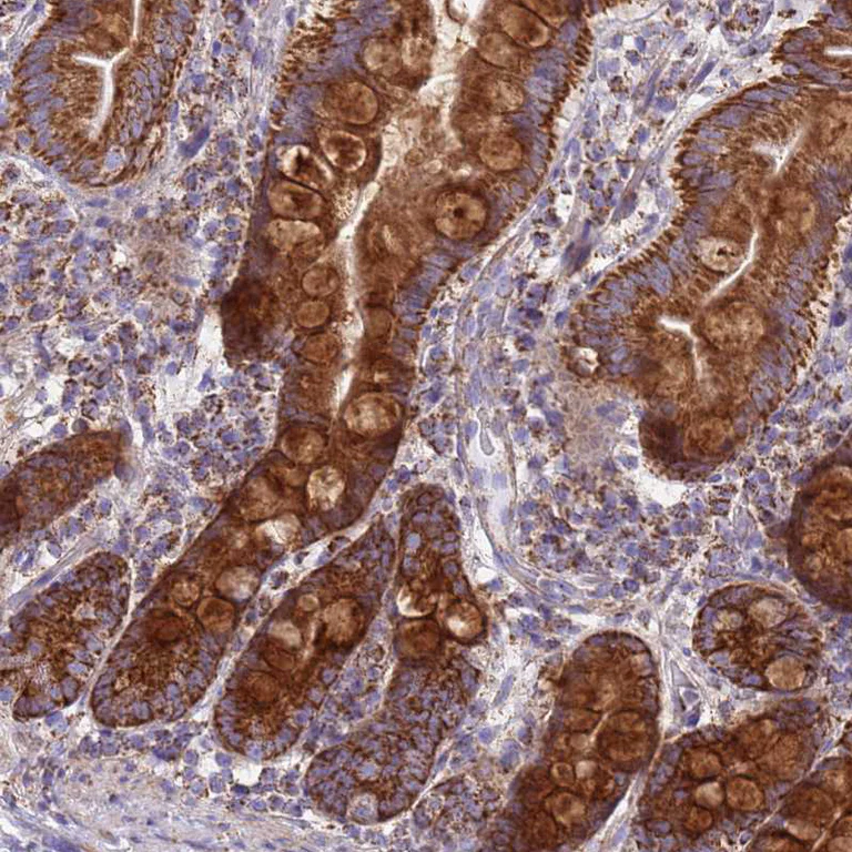 Immunohistochemistry (Formalin/PFA-fixed paraffin-embedded sections) - Anti-COQ4 antibody (AB126295)