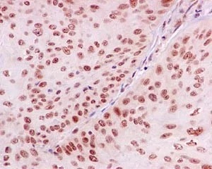 Immunohistochemistry (Formalin/PFA-fixed paraffin-embedded sections) - Anti-CoREST antibody [EPR13825] - BSA and Azide free (AB250687)