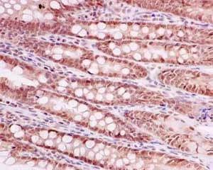 Immunohistochemistry (Formalin/PFA-fixed paraffin-embedded sections) - Anti-CoREST antibody [EPR13825] - BSA and Azide free (AB250687)