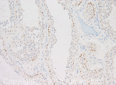 Immunohistochemistry (Formalin/PFA-fixed paraffin-embedded sections) - Anti-CoREST2 / RCOR2 antibody (AB37113), expandable thumbnail
