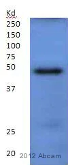 Western blot - Anti-CoREST2 / RCOR2 antibody (AB37113)