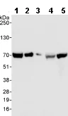 Western blot - Anti-CoREST3 / RCOR3 antibody (AB76921)