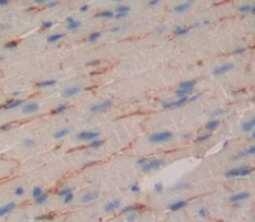 Immunohistochemistry (Formalin/PFA-fixed paraffin-embedded sections) - Anti-Corin antibody (AB232842)