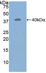 Western blot - Anti-Corin antibody (AB232842)