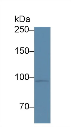 Western blot - Anti-Corin antibody (AB232842)
