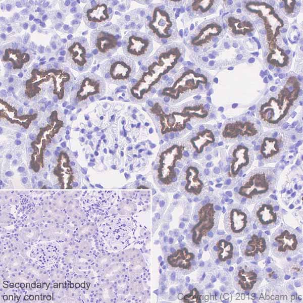 Immunohistochemistry (Formalin/PFA-fixed paraffin-embedded sections) - Anti-Corin antibody [EPR22613-21] (AB255812), expandable thumbnail