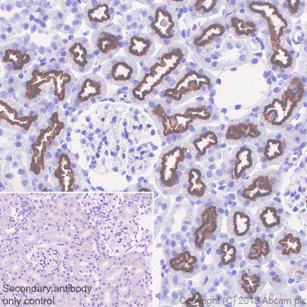 Immunohistochemistry (Formalin/PFA-fixed paraffin-embedded sections) - Anti-Corin antibody [EPR22613-21] (AB255812)