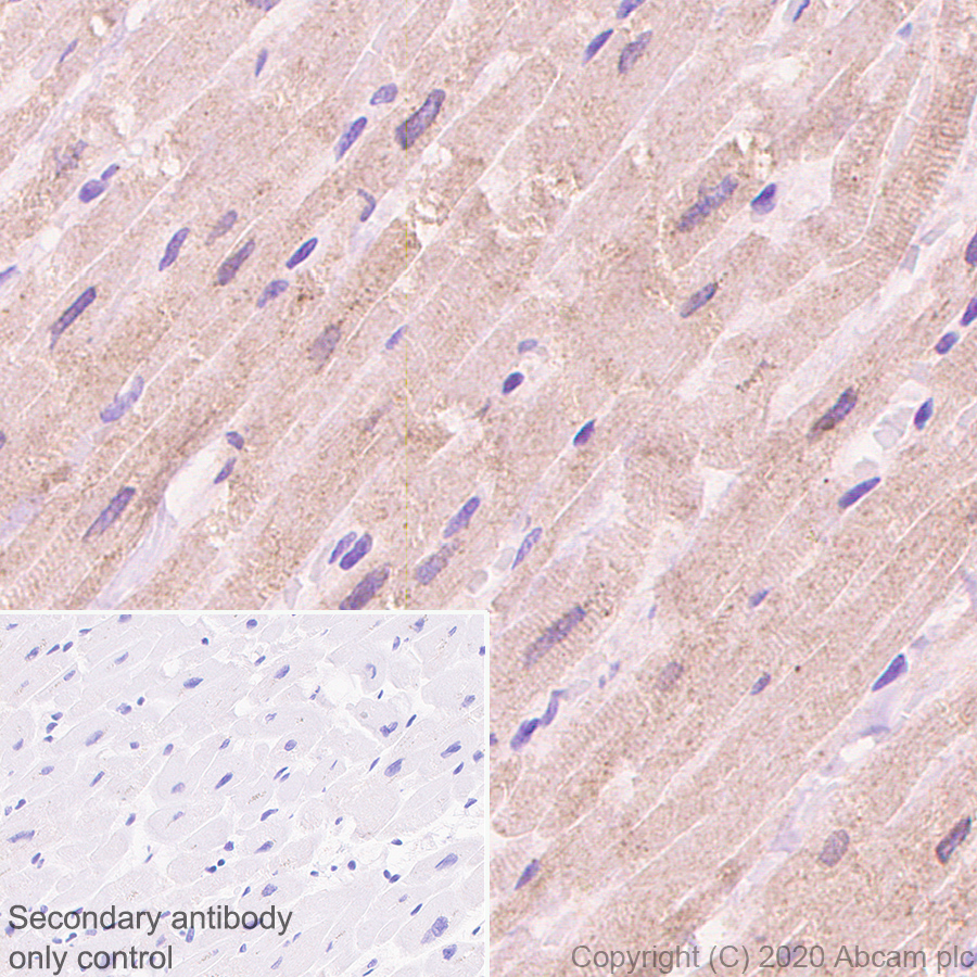Immunohistochemistry (Formalin/PFA-fixed paraffin-embedded sections) - Anti-Corin antibody [EPR23361-77] (AB274320), expandable thumbnail