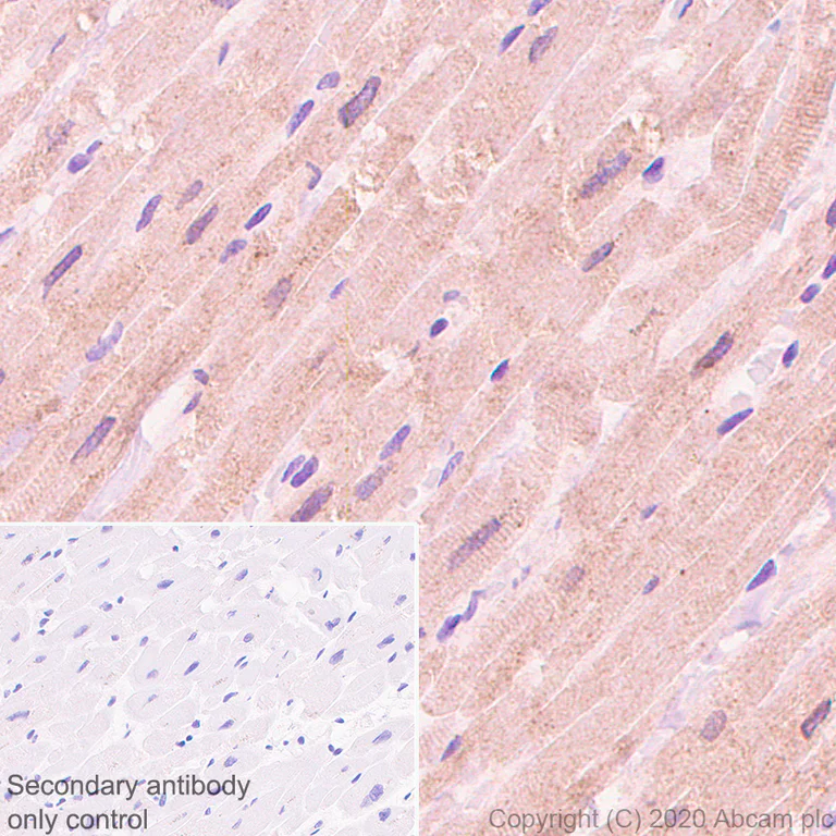 Immunohistochemistry (Formalin/PFA-fixed paraffin-embedded sections) - Anti-Corin antibody [EPR23361-77] (AB274320)