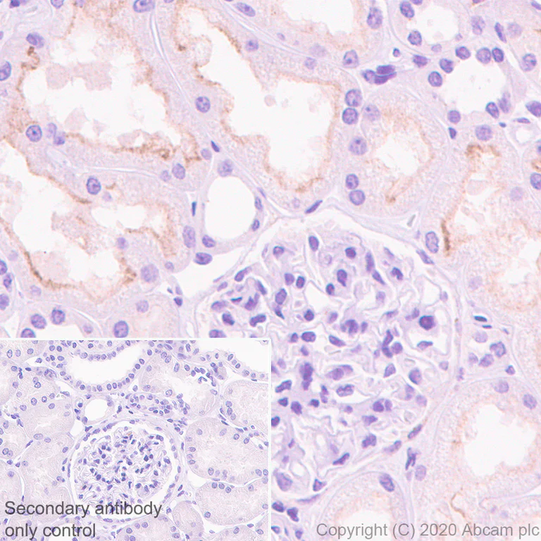 Immunohistochemistry (Formalin/PFA-fixed paraffin-embedded sections) - Anti-Corin antibody [EPR23361-77] - BSA and Azide free (AB274323)