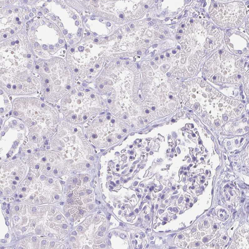 Immunohistochemistry (Formalin/PFA-fixed paraffin-embedded sections) - Anti-Corneodesmosin/S protein antibody (AB204235), expandable thumbnail