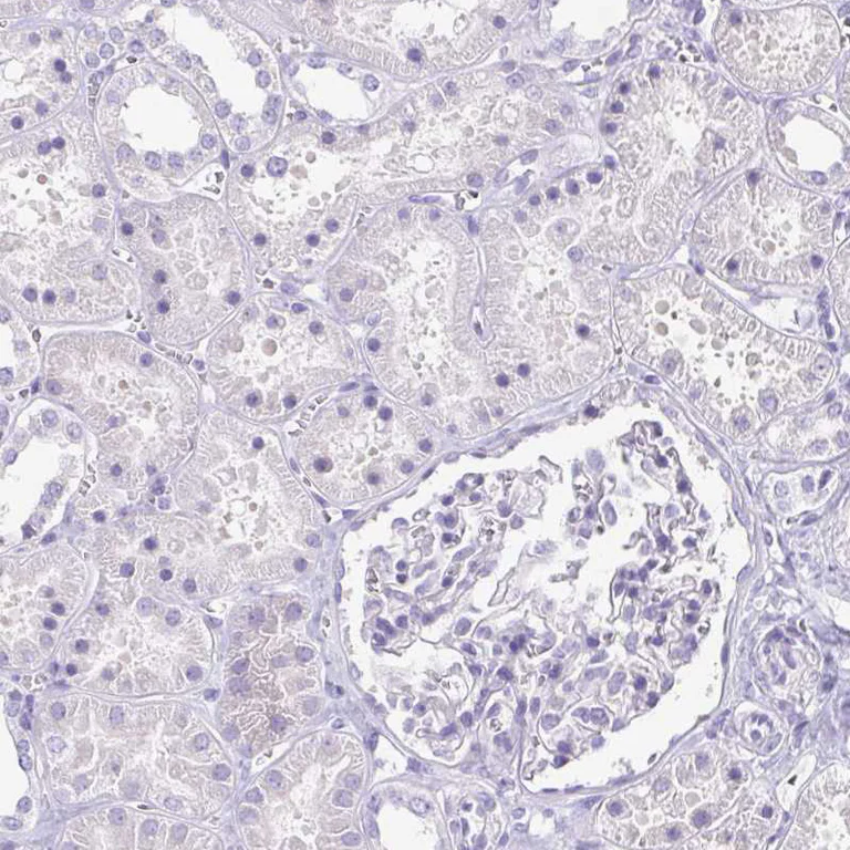 Immunohistochemistry (Formalin/PFA-fixed paraffin-embedded sections) - Anti-Corneodesmosin/S protein antibody (AB204235)
