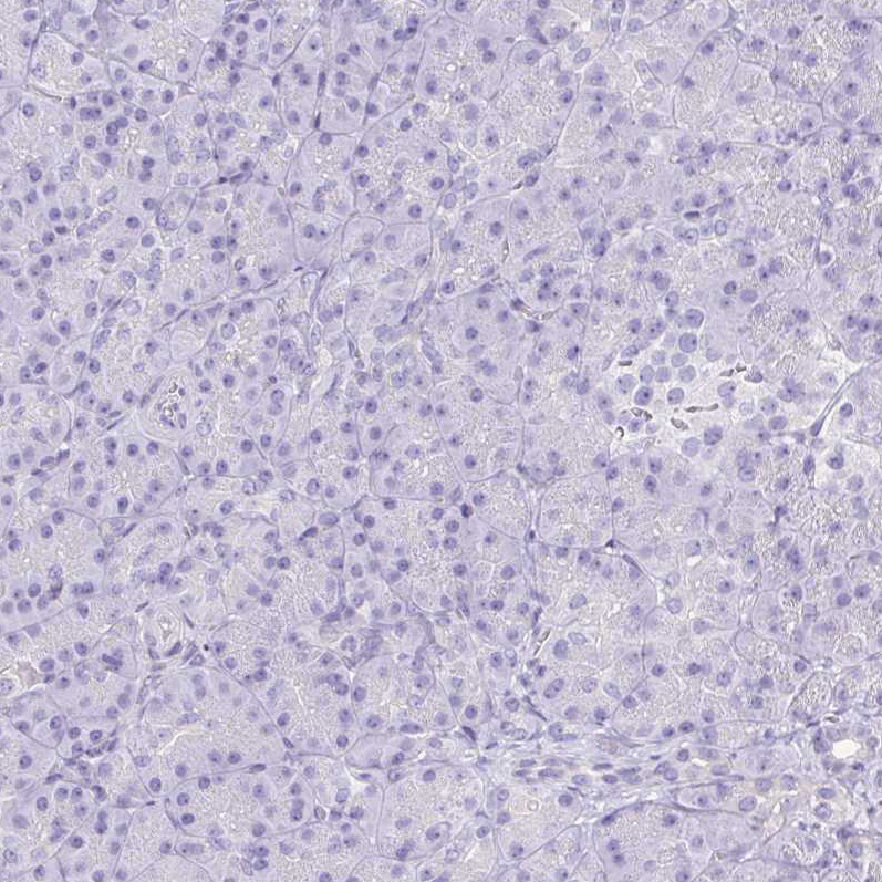 Immunohistochemistry (Formalin/PFA-fixed paraffin-embedded sections) - Anti-Corneodesmosin/S protein antibody (AB204235), expandable thumbnail