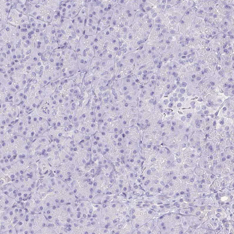 Immunohistochemistry (Formalin/PFA-fixed paraffin-embedded sections) - Anti-Corneodesmosin/S protein antibody (AB204235)