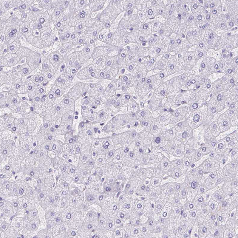 Immunohistochemistry (Formalin/PFA-fixed paraffin-embedded sections) - Anti-Corneodesmosin/S protein antibody (AB204235), expandable thumbnail