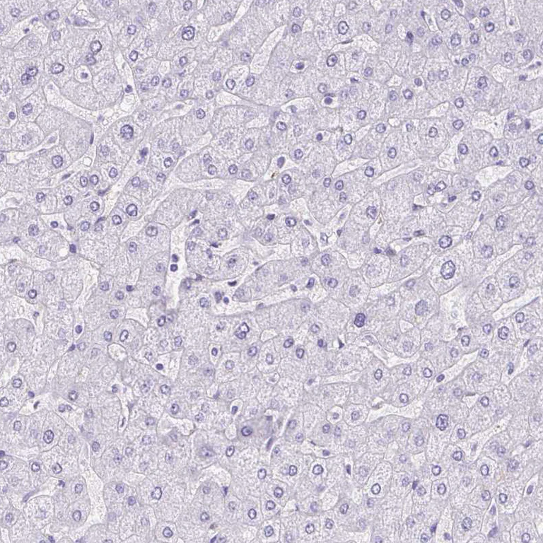 Immunohistochemistry (Formalin/PFA-fixed paraffin-embedded sections) - Anti-Corneodesmosin/S protein antibody (AB204235)