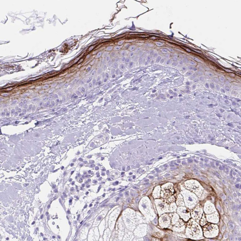 Immunohistochemistry (Formalin/PFA-fixed paraffin-embedded sections) - Anti-Corneodesmosin/S protein antibody (AB204235), expandable thumbnail