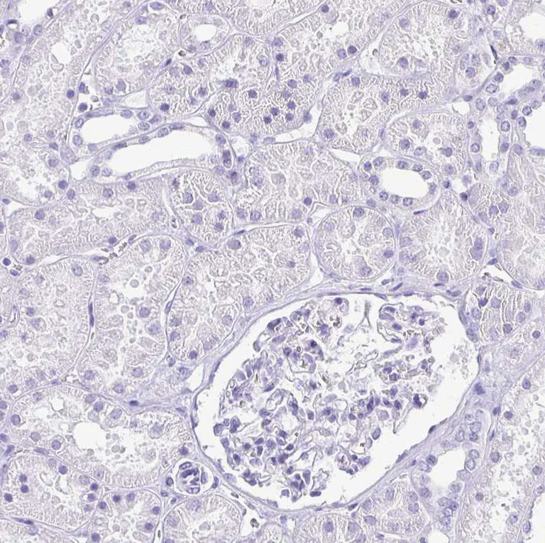 Immunohistochemistry (Formalin/PFA-fixed paraffin-embedded sections) - Anti-Corneodesmosin/S protein antibody (AB244476)