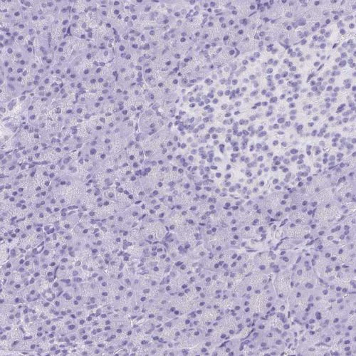 Immunohistochemistry (Formalin/PFA-fixed paraffin-embedded sections) - Anti-Corneodesmosin/S protein antibody (AB244476)