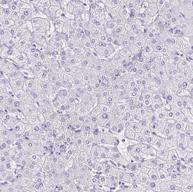 Immunohistochemistry (Formalin/PFA-fixed paraffin-embedded sections) - Anti-Corneodesmosin/S protein antibody (AB244476)