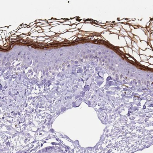Immunohistochemistry (Formalin/PFA-fixed paraffin-embedded sections) - Anti-Corneodesmosin/S protein antibody (AB244476)