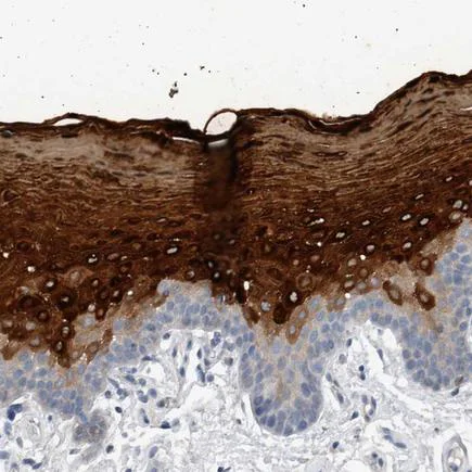 Immunohistochemistry (Formalin/PFA-fixed paraffin-embedded sections) - Anti-Cornulin antibody (AB224122)
