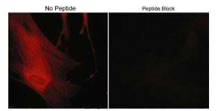 Immunocytochemistry/ Immunofluorescence - Anti-CORO1B antibody (AB119714)