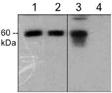 Western blot - Anti-CORO1B antibody (AB119714)