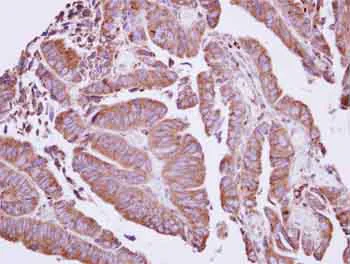 Immunohistochemistry (Formalin/PFA-fixed paraffin-embedded sections) - Anti-CORO2A antibody (AB155305)