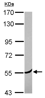 Western blot - Anti-CORO2A antibody (AB155305)