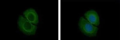 Immunocytochemistry/ Immunofluorescence - Anti-CORO2B antibody (AB151327)