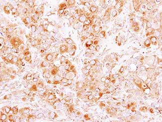 Immunohistochemistry (Formalin/PFA-fixed paraffin-embedded sections) - Anti-CORO2B antibody (AB151327)